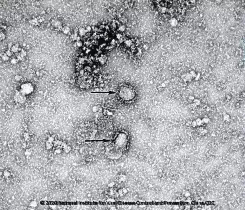 ▲新型冠狀病毒武漢株01。照片來源：國家病原微生物資源庫（中國疾病預防控制中心病毒病預防控制所）